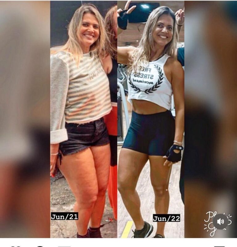 antes e depois 2