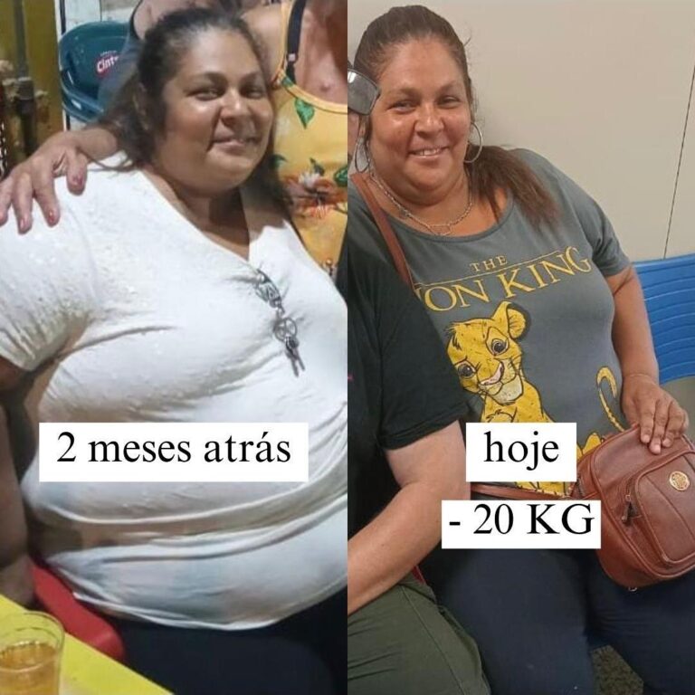 antes e depois 1